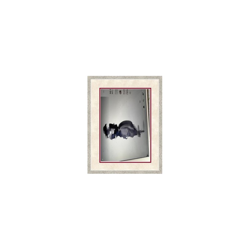PRODUCT-2814